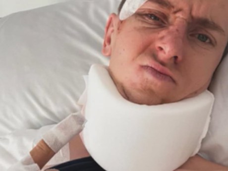Pogacar in ospedale dopo la caduta: fratture e addio al Mondiale